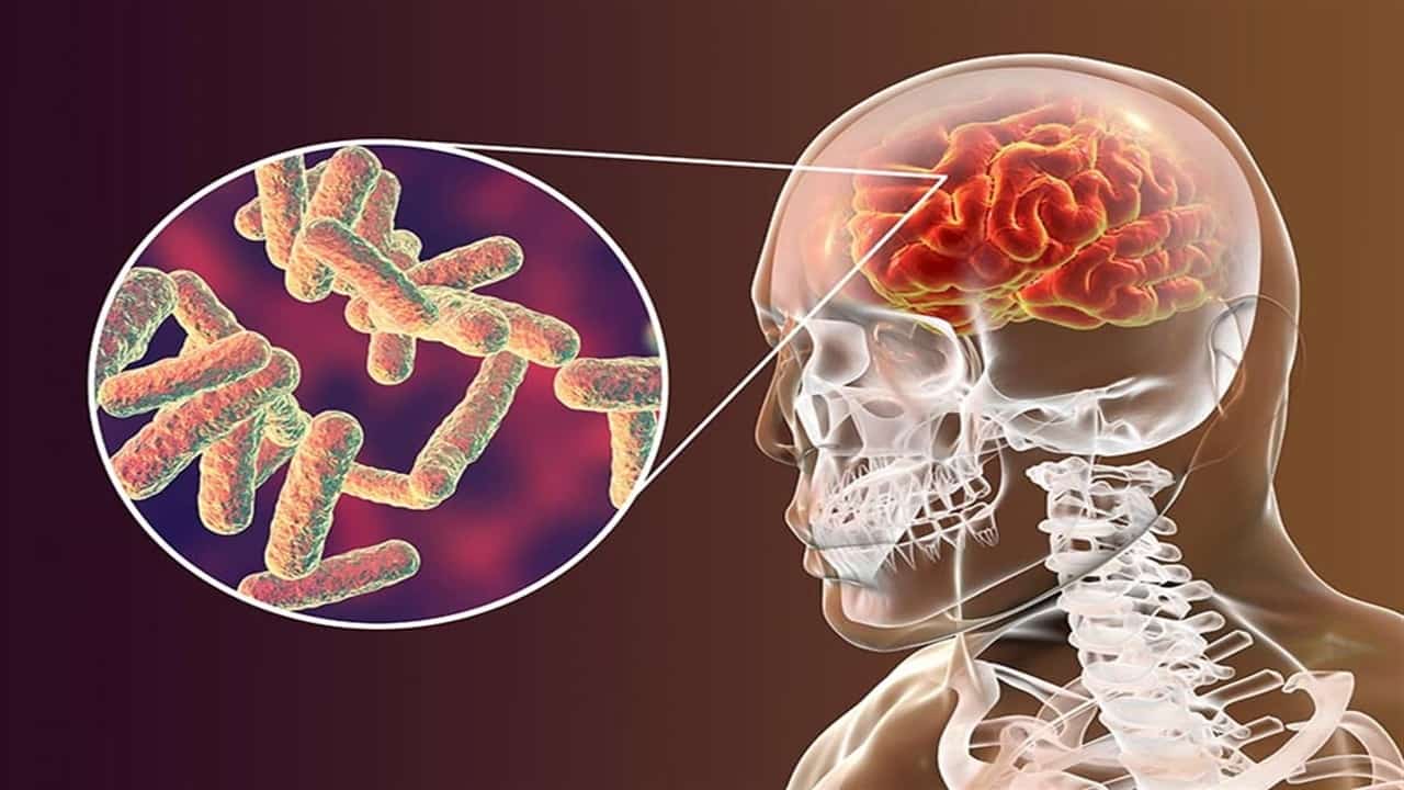 Sanofi ve Menenjit Topluluğu, “Menenjit Bayrağı” Hareketiyle Menenjit İle Savaşacak